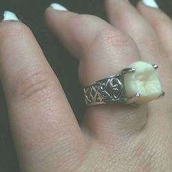 Невеста получила обручальное кольцо с зубом жениха